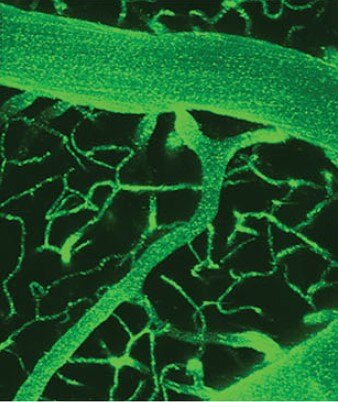 Labelled vessels - Green